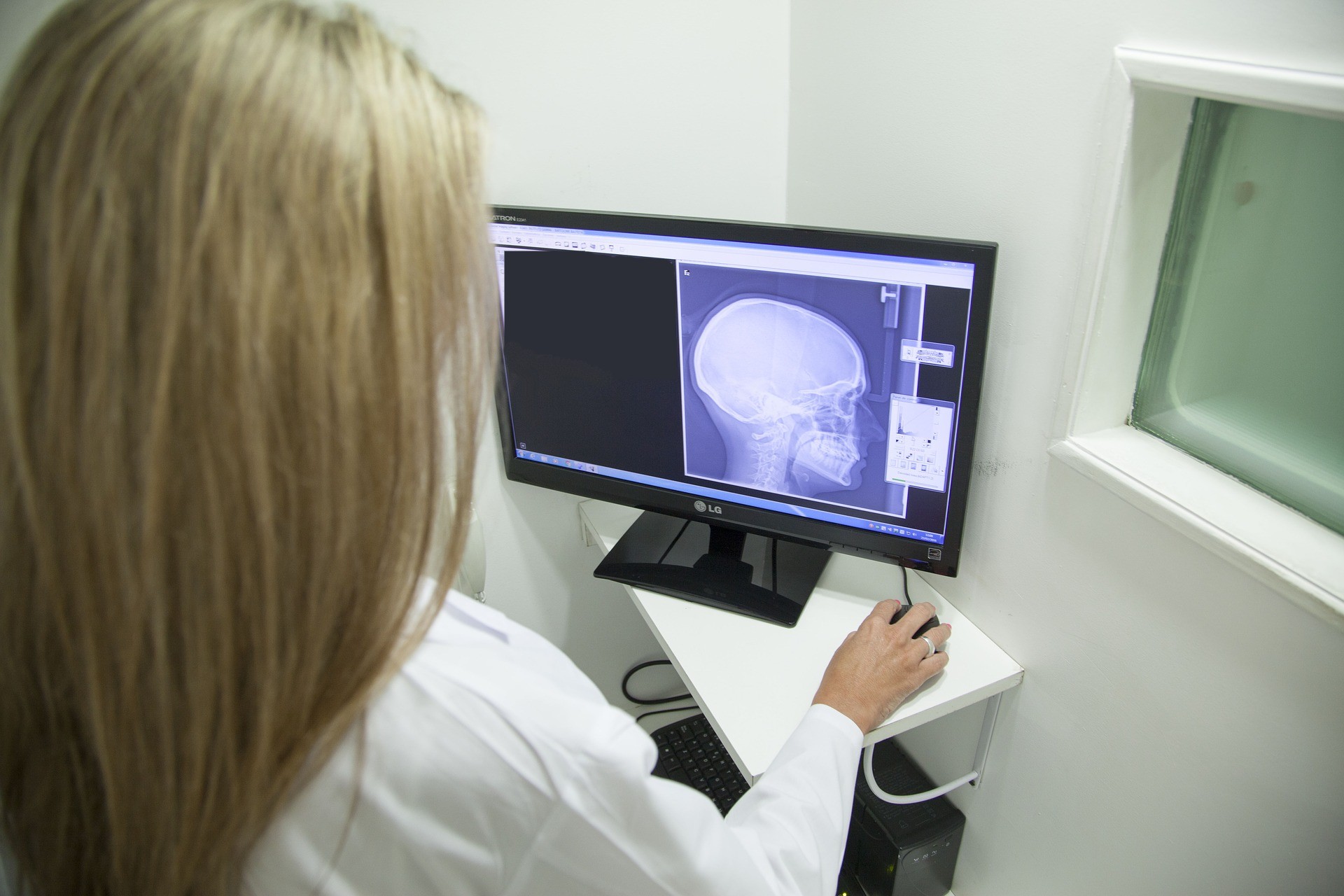 Día Mundial del Cerebro